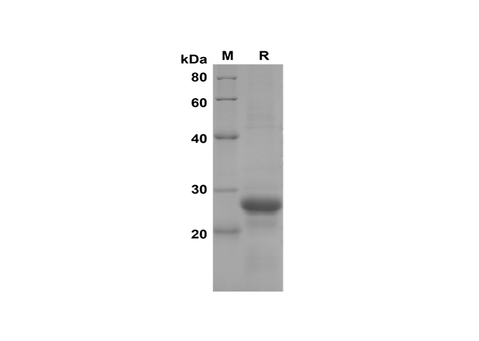 Recombinant Human IL17D Protein(Sumo Tag)-产品推荐-1