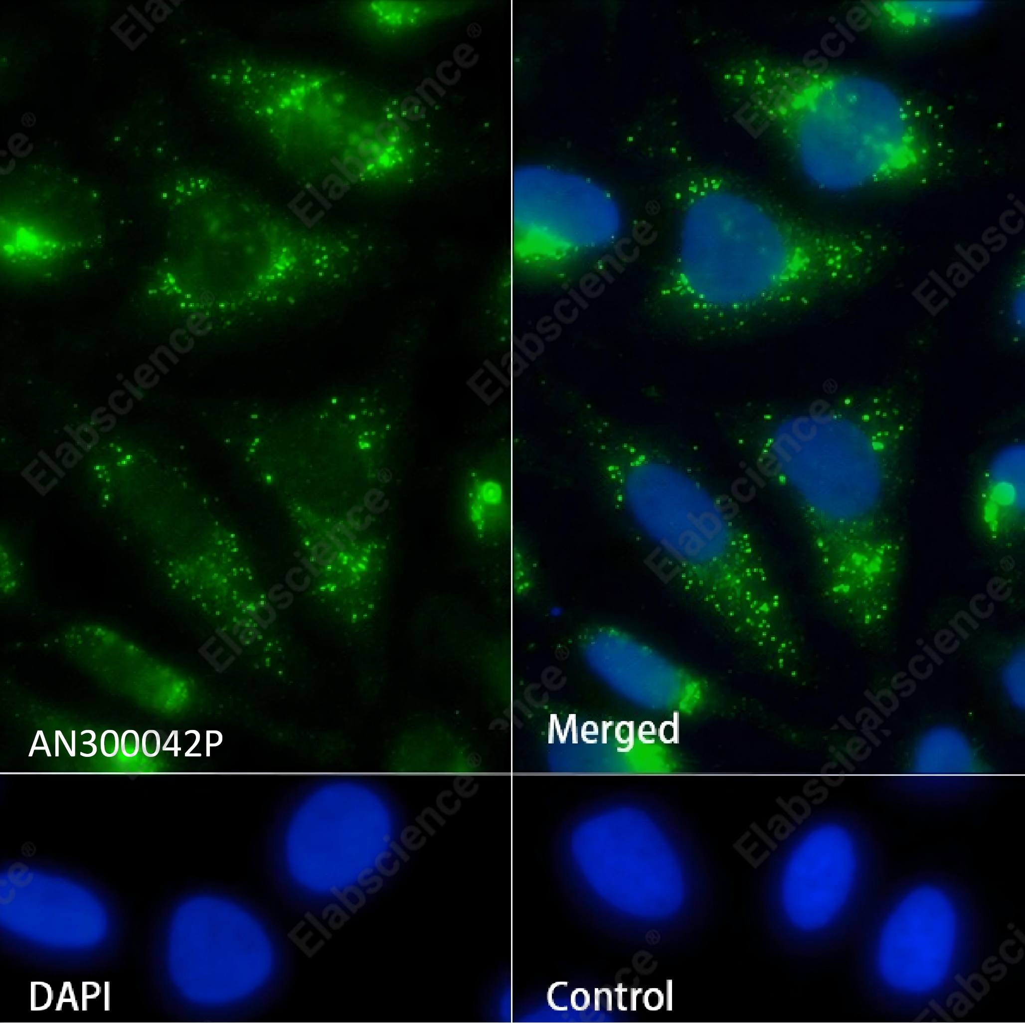 Recombinant CD50/ICAM-3 Monoclonal Antibody - 2
