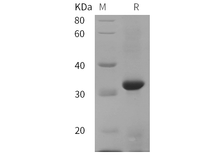 Recombinant Human IL15 Protein-产品推荐-1