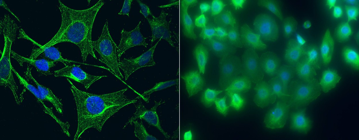 S100A5 Monoclonal Antibody-searchlist-1