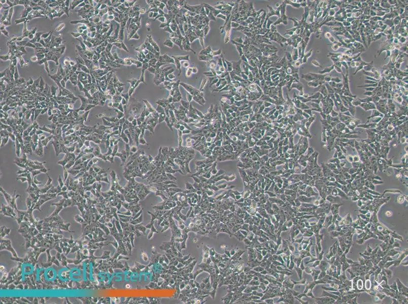 P19 Cell Complete Medium - 1
