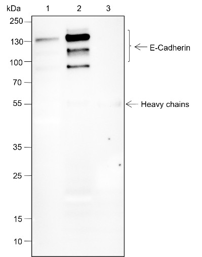 Recombinant E-Cadherin Monoclonal Antibody - 3