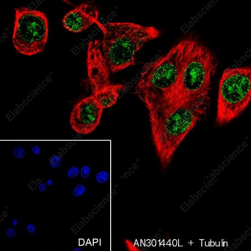 Recombinant Ataxin-3 Monoclonal Antibody - 5