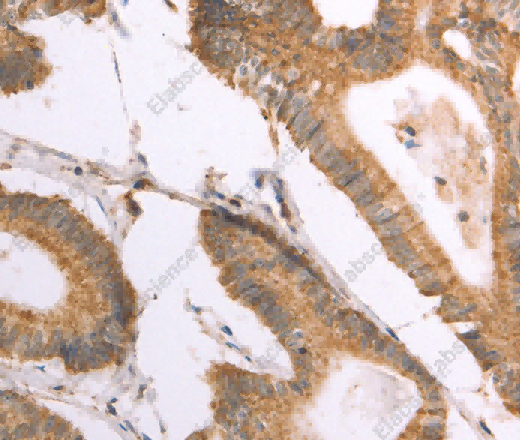 NAMPT Polyclonal Antibody - 2