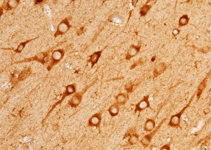 Recombinant Angiotensinogen/SerpinA8/AGT Monoclonal Antibody - small - 2