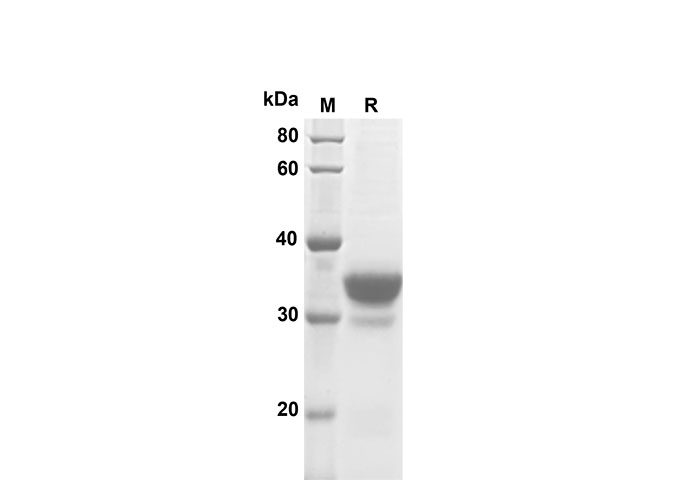 Recombinant Human EGF Protein(Fc Tag)-产品推荐-2