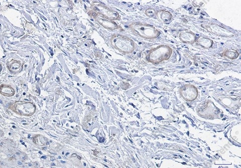 Recombinant cAMP Protein Kinase Catalytic subunit Monoclonal Antibody - 4