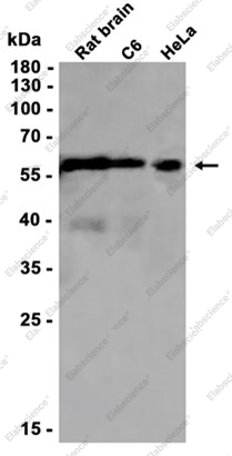 Recombinant P70 S6 Kinase beta Monoclonal Antibody - 1