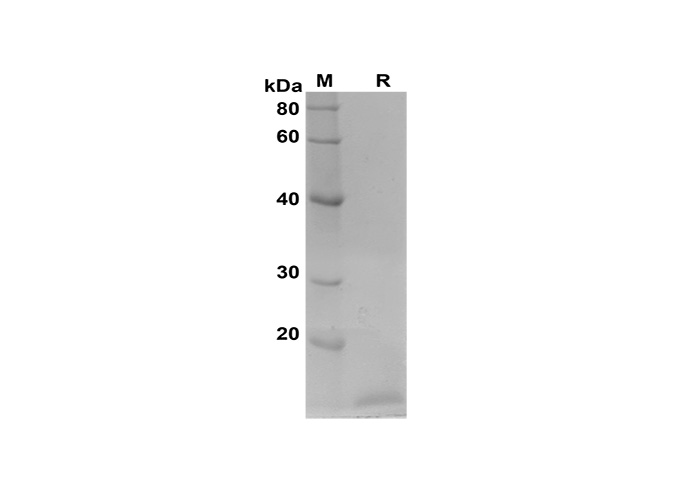 Recombinant Human IL18 Protein(Avi,His Tag)-产品推荐-1