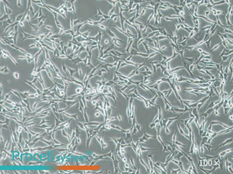 WM115 Cell Complete Medium - 1