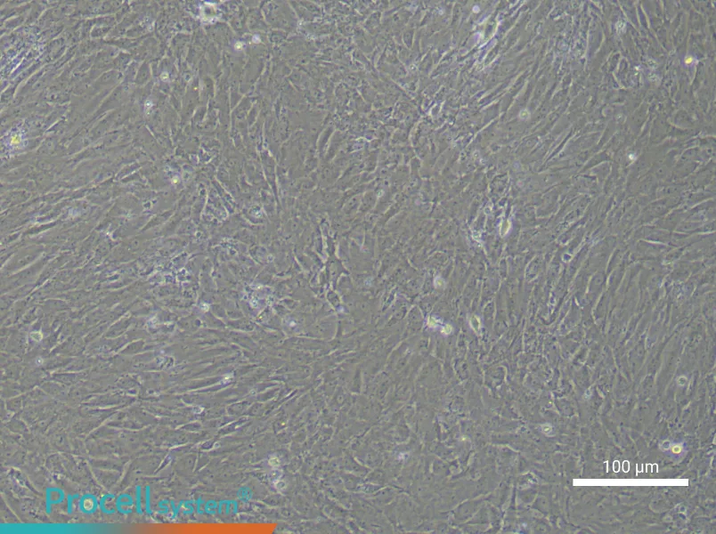 Rat Follicle Membrane Cell Complete Medium - 1