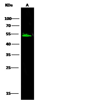 Recombinant SerpinA8/Angiotensinogen/AGT Monoclonal Antibody - small - 4