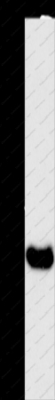 BAAT Polyclonal Antibody - 1