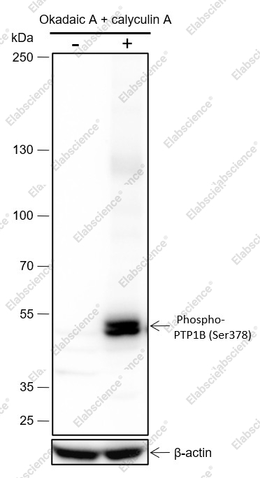 Recombinant Phospho-PTP1B (Ser378) Monoclonal Antibody - 1