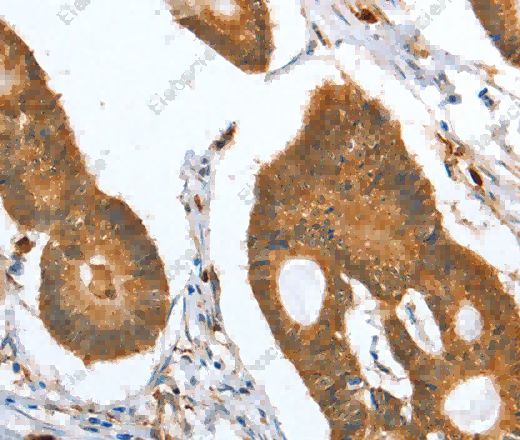 CAPG Polyclonal Antibody - 3