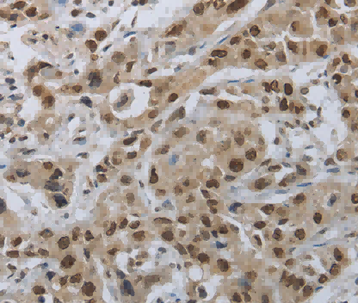 PRKAR1B Polyclonal Antibody - 3