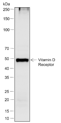 Recombinant Vitamin D Receptor Monoclonal Antibody - 2