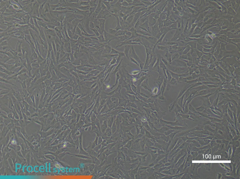 Rat Pulmonary Arteriolar Smooth Muscle Cell Complete Medium - 3