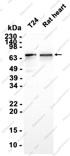 Recombinant YTHDF3 Monoclonal Antibody - 1