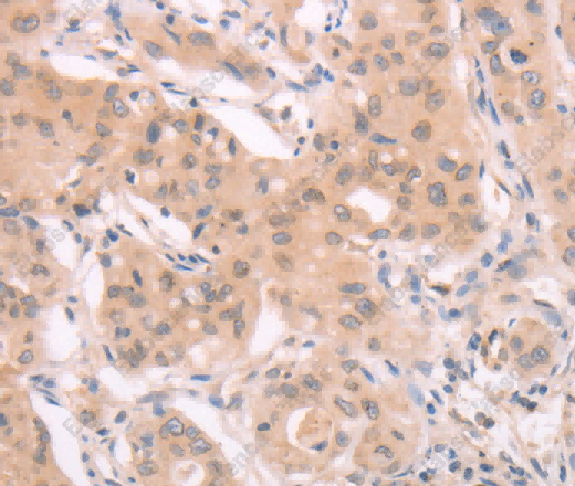 ADAM11 Polyclonal Antibody - 3