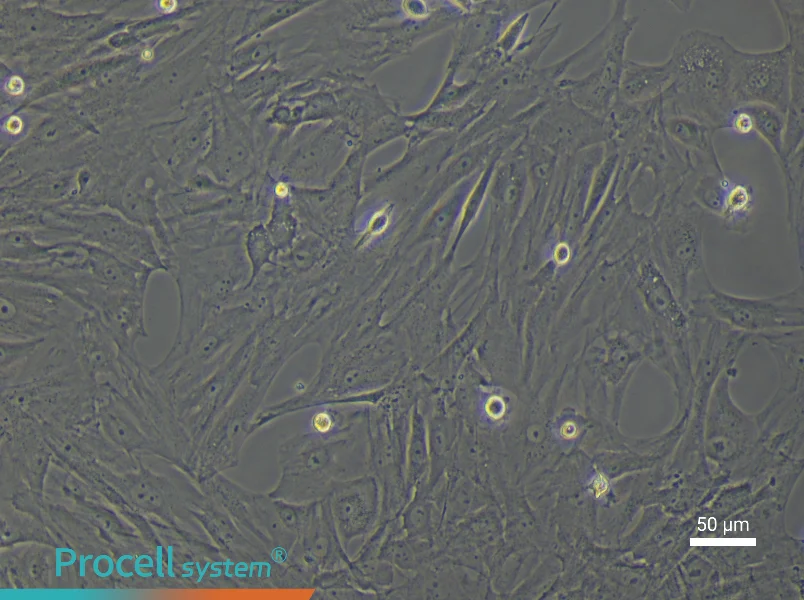 Rat Uterine Fibroblast Complete Medium - 6