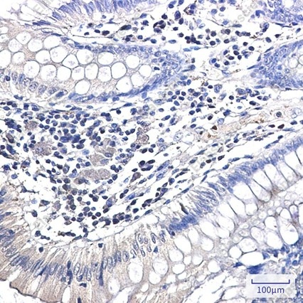 Recombinant Ubiquitin K63 Monoclonal Antibody - 2