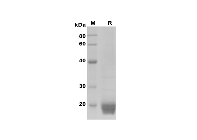 Recombinant Mouse CD30 Ligand/TNFSF8 Protein(Fc Tag)-产品推荐-1