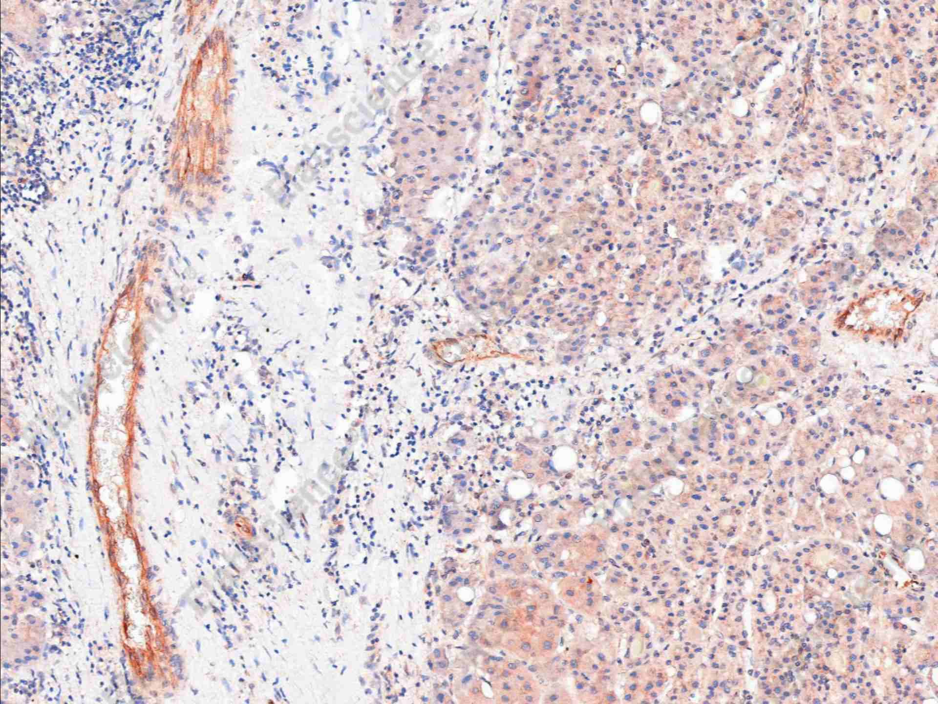 Recombinant Collagen III Monoclonal Antibody - 1