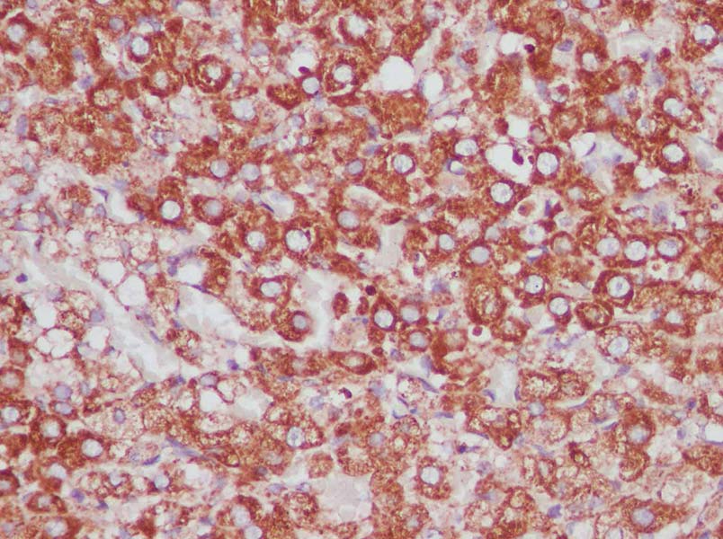 Purified Anti-Human CD193 Antibody[5E8]-产品推荐-1