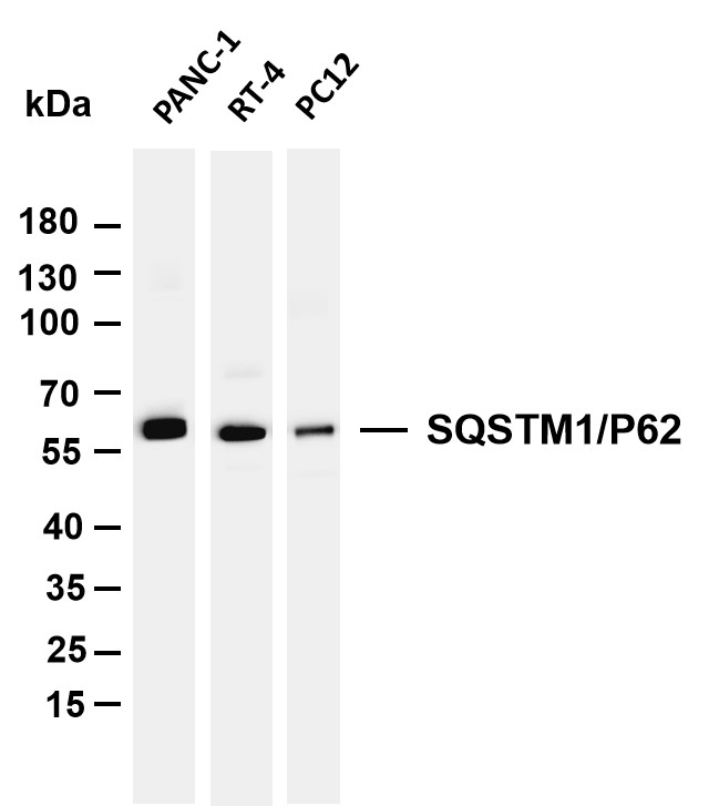 Recombinant SQSTM1/p62 Monoclonal Antibody-searchlist-1