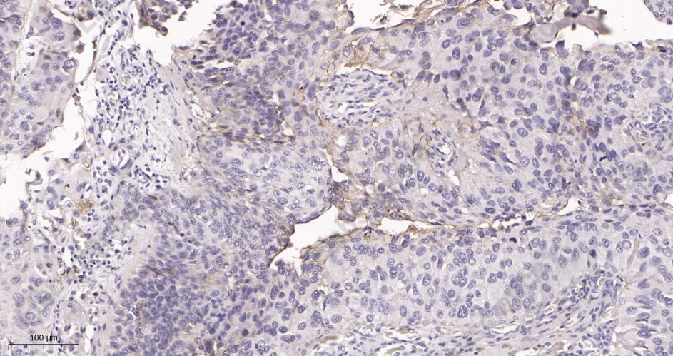 Recombinant IGF1 Receptor Monoclonal Antibody - 2