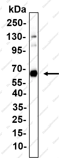 Recombinant IGF2-BP2 Monoclonal Antibody - 4