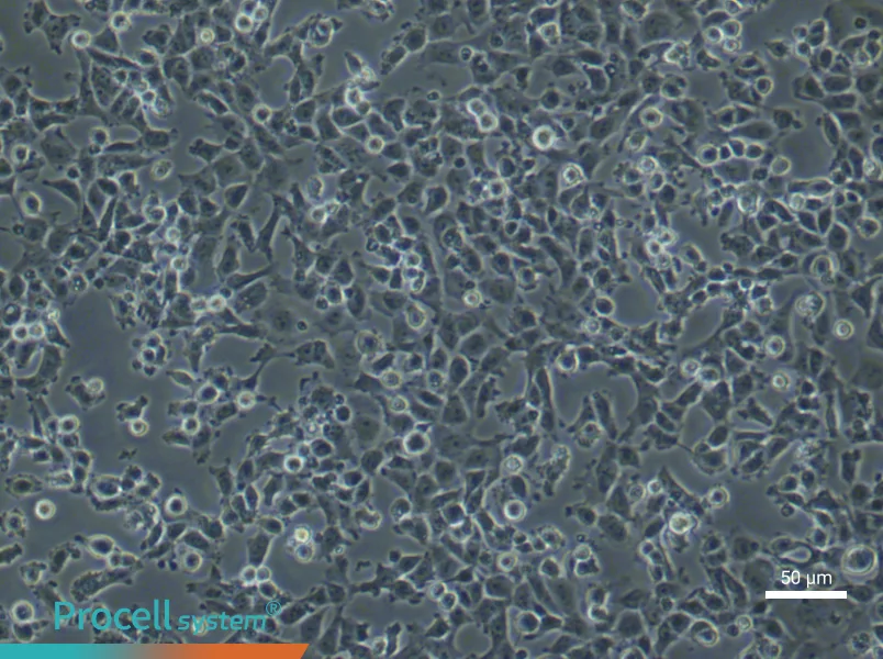 Rat Aortic Endothelial (Primary cell immortalization) Cell Complete MediumRat Aortic Endothelial (Primary cell immortalization) Cell Complete Medium - 4