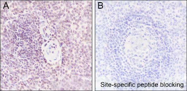 Recombinant Histone H3 (Acetyl Lys122) Monoclonal Antibody - small - 5