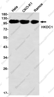 Recombinant HKDC1 Monoclonal Antibody - 1