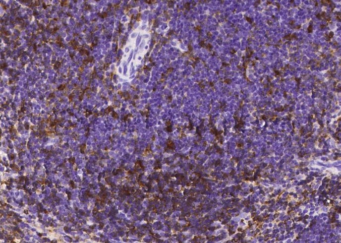 Recombinant CD180/RP105 Monoclonal Antibody - small - 2