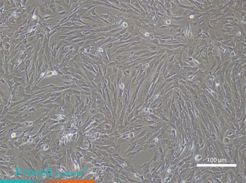 Rat Bladder Smooth Muscle Cell Complete Medium - 3