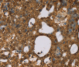 PSMC2 Polyclonal Antibody - 2