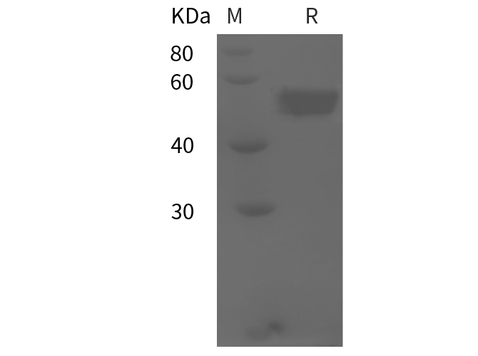 Recombinant Human CEACAM8/CD66b/CD67 Protein(His Tag)-产品推荐-1