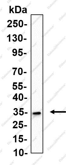 Recombinant FOLR1 Monoclonal Antibody - 2