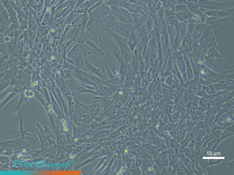 Rat Pulmonary Artery Smooth Muscle Cells (Primary cell immortalization)Rat Pulmonary Artery Smooth Muscle Cells (Primary cell immortalization) - 6