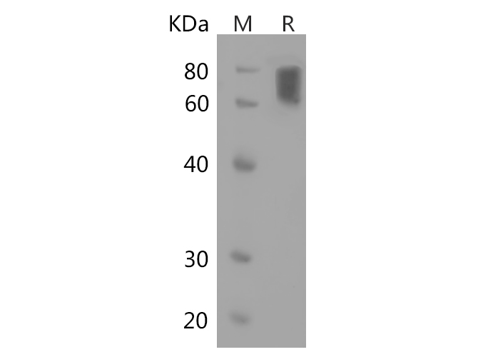 Recombinant Human IL17D Protein(Sumo Tag)-产品推荐-1
