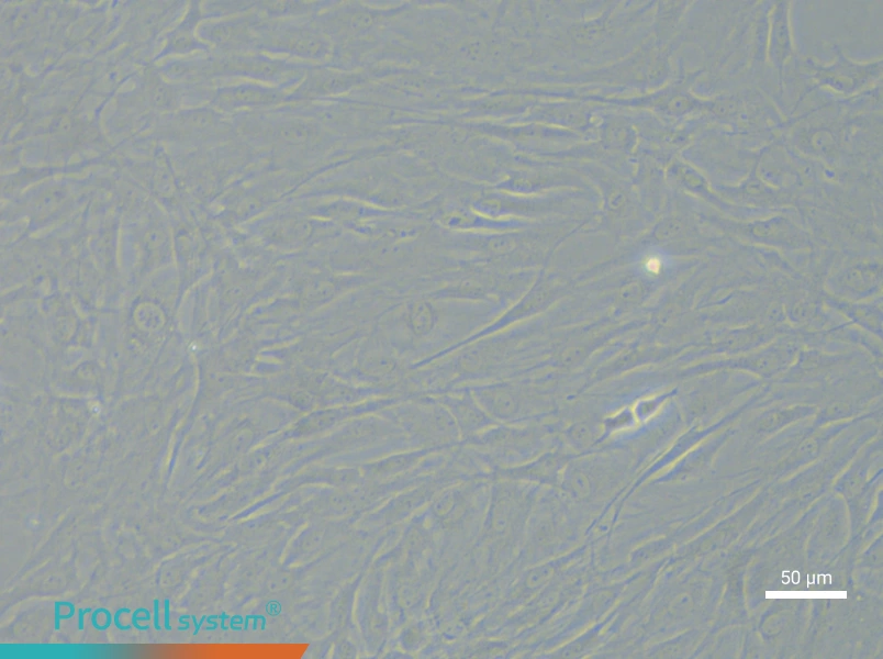 Rat Chondrocyte (Primary cell immortalization) Complete MediumRat Chondrocyte (Primary cell immortalization) Complete Medium - 5