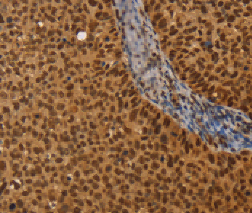 CEL Polyclonal Antibody - 2
