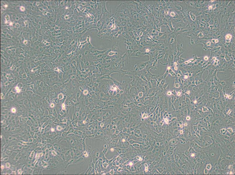 B-CPAP [BC-PAP; BCPAP] Cell Complete Medium - 3