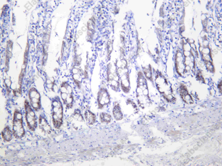 Recombinant HNF1A Monoclonal Antibody - 2