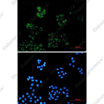 Recombinant IRAK4 Monoclonal Antibody - 2