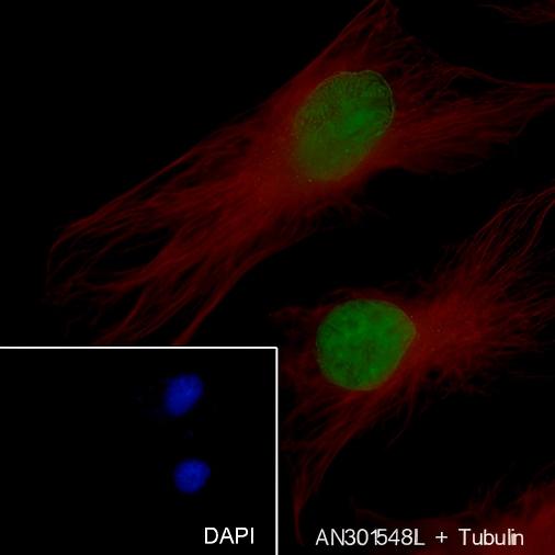 Recombinant Histone H1 (CT) Monoclonal Antibody - small - 4