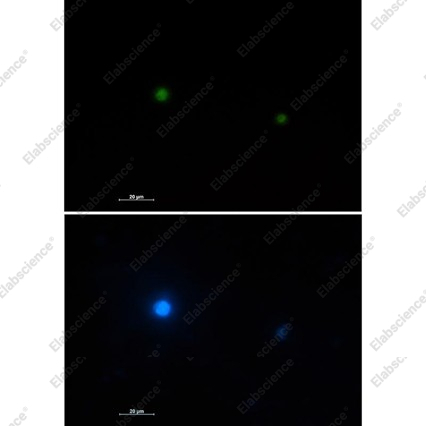Recombinant MBD2 Monoclonal Antibody - 3