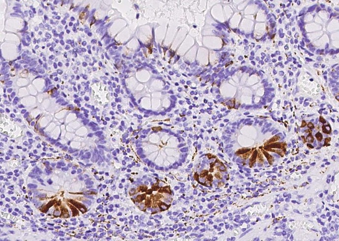 Recombinant Synaptophysin/SYP Monoclonal Antibody - small - 2